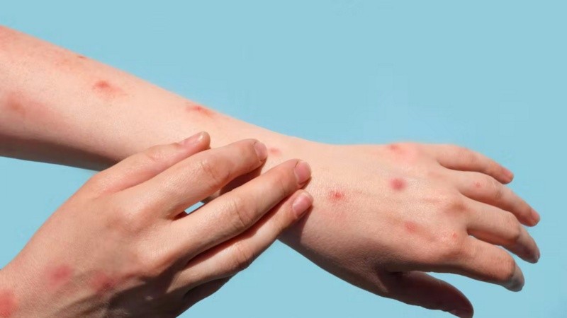 Los casos en Argentina están concentrados mayormente en Buenos Aires.