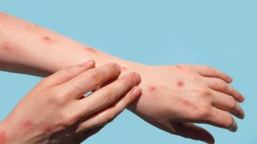 Los casos en Argentina están concentrados mayormente en Buenos Aires.