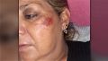 Inspectora golpeada por un automovilista en la marcha contra la violencia machista