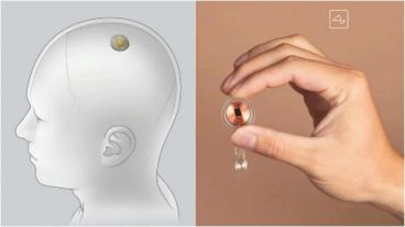 La empresa ya había probado uno de sus chips implantándolo en el cerebro de un mono.