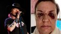 Axl Rose revoleó el micrófono y una mujer denunció que le desfiguró la cara en pleno concierto: "Pudo haberme matado"