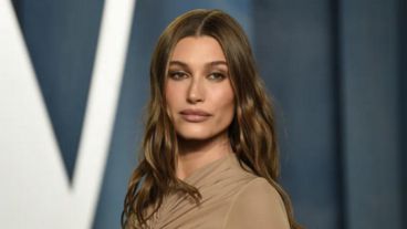 A principios de este año, la modelo confesó que había sufrido síntomas similares a los de un derrame cerebral.