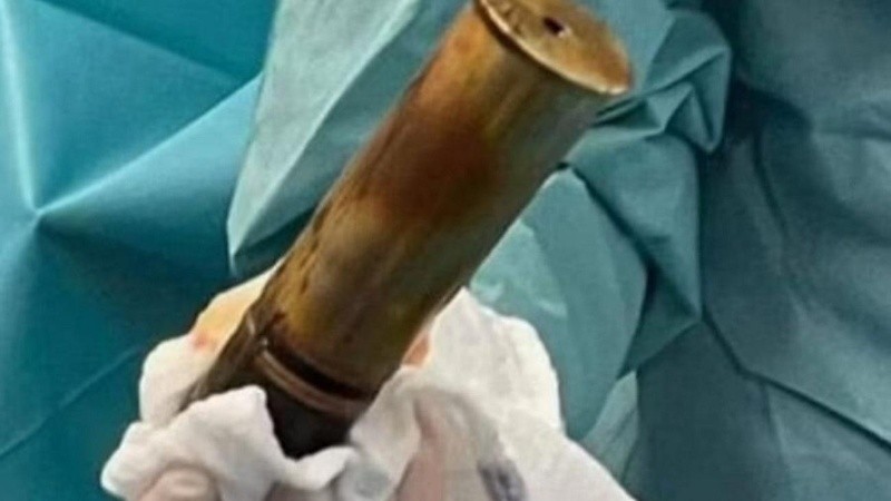 Medía 20 cm de largo y más de 5 cm de ancho.