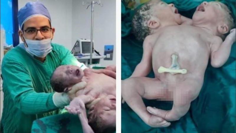 Es poco probable que los hermanos se separen alguna vez.