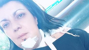 Noel fue herida mientras participaba de un festejo de cumpleaños en Empalme Graneros.