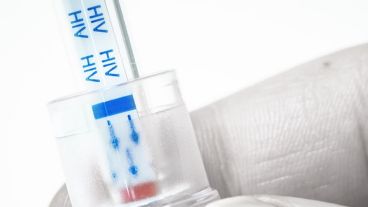 El tercer caso de VIH curado, según los estudios médicos.