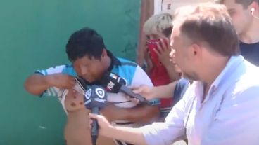 El papá del nene asesinado muestra las heridas por bala de goma.