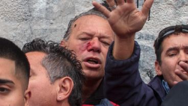 El funcionario fue atacado a golpes y piedrazos en el marco de un piquete.