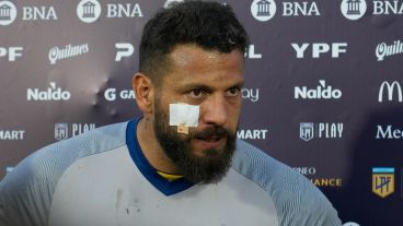 Broun, tras el empate clásico, con un apósito sobre el corte.