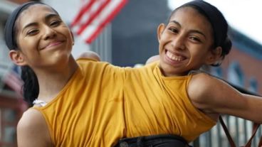 "Si nos operamos, una de nosotros moriría seguro. La otra también fallecería o terminaría en la unidad de cuidados intensivos y nunca saldríamos".