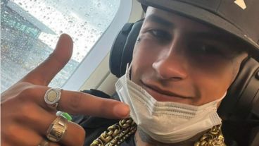 El cantante mostró en su cuenta de Instagram su "nueva dentadura".