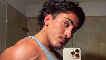 "Todavía no están los cambios finales, porque tengo que esperar a que se sanen estas gacitas y que se deshinchen".