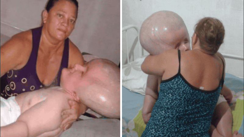 La mujer cuida de su hija y toda la familia colabora en su atención.