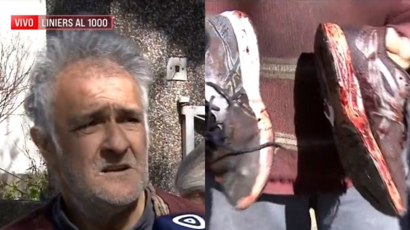 Héctor, uno de los hombres atacados por el pitbull el domingo en barrio Azcuénaga y la imagen de sus zapatillas teñidas de sangre por las heridas.