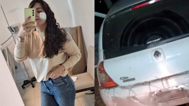 Brenda ya recibió el alta. El agresor continúa prófugo.