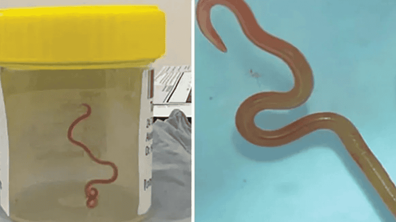 El gusano encontrado generalmente se halla en las serpientes, no en las personas.