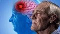La infección por ciertos patógenos podría contribuir a la neurodegeneración propia de este tipo de demencia.