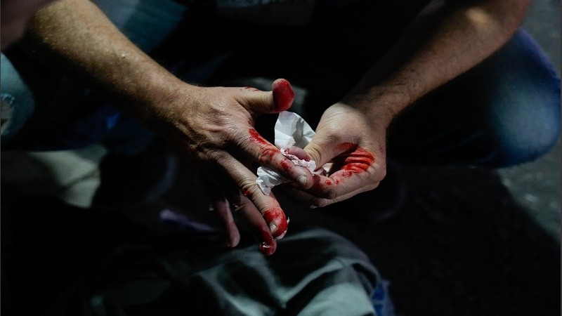 Los familiares y amigos de Ivana pintaron la estrella poco antes de la ceremonia.