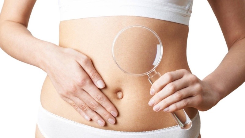 Una patología que se hizo conocida a raíz de influencers y celebridades que manifestaron padecerla.