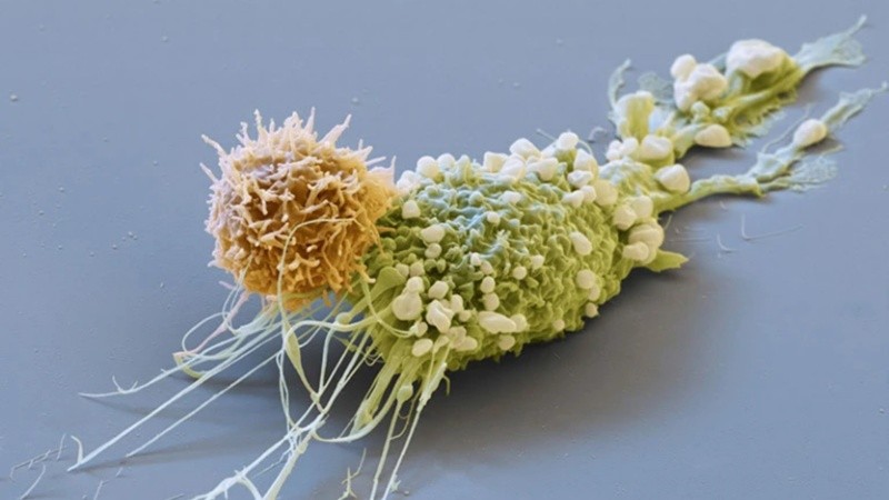 Una célula de cáncer de mama -verde- es atacada por una célula CAR-T -naranja-.