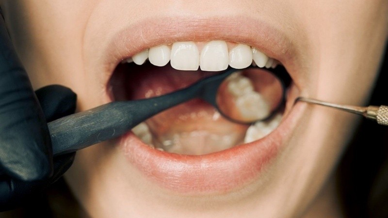 El control odontológico, mínimamente anual, resulta clave para conocer los cuidados particulares de la propia boca.