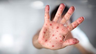 La vacuna es gratuita, obligatoria y se aplica en todos los vacunatorios y centros de salud del país.