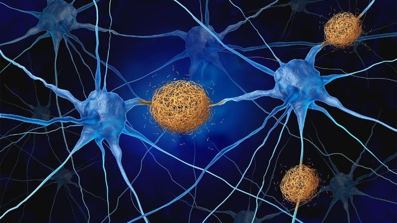 Investigaciones han demostrado que la reserva cognitiva ayuda a evitar los síntomas de cambios cerebrales degenerativos.