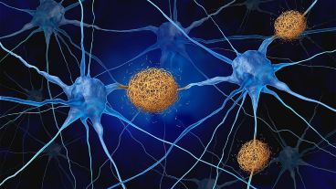 Investigaciones han demostrado que la reserva cognitiva ayuda a evitar los síntomas de cambios cerebrales degenerativos.