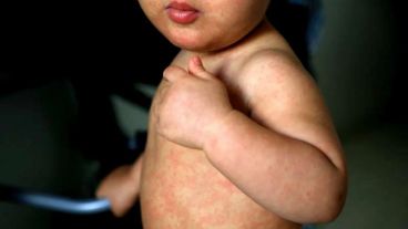 Este año hay un incremento temprano de casos, lo que sugiere que la situación podría intensificarse en los próximos meses.