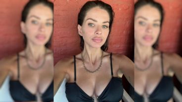 La China Suárez se fracturó la nariz.