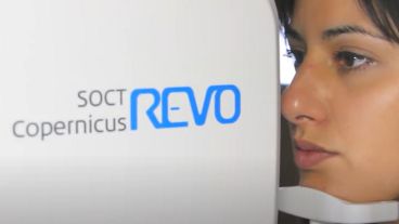 El tomógrafo de coherencia óptica en acción.