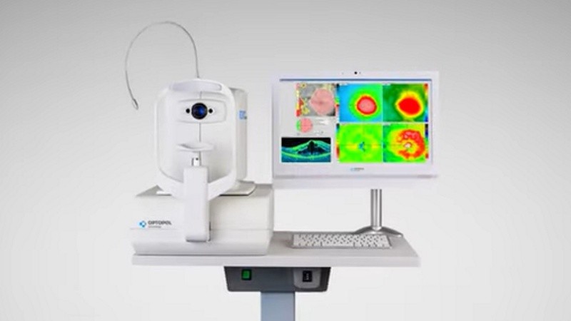 El tomógrafo de coherencia óptica.