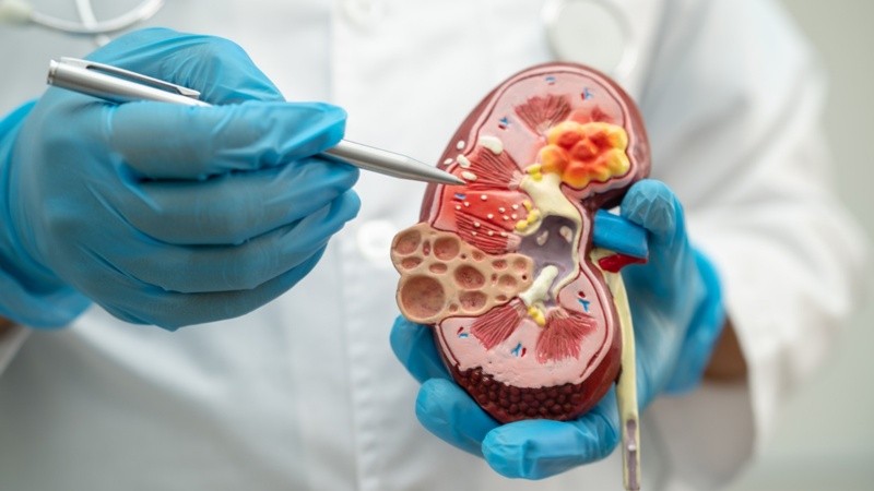 Expertos resaltan la importancia de un diagnóstico precoz de esta y de las patologías con las que está vinculada.