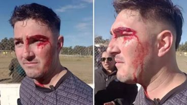 Así quedó el árbitro del encuentro tras la agresión.