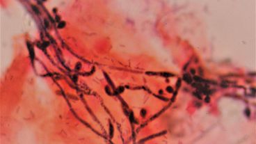 El hallazgo permite pensar en la creación de nuevos antifúngicos.