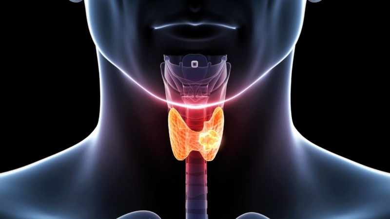 Se trata de uno de los padecimientos más recurrentes en mujeres.