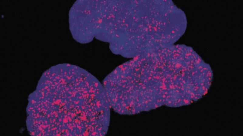 Las células que persisten a los tratamientos actúan a modo de 