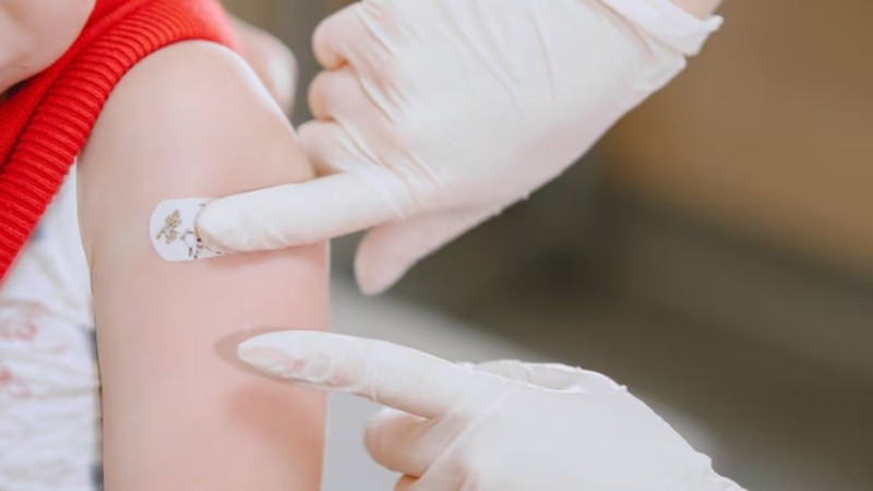 El sarampión es una enfermedad viral sumamente contagiosa.