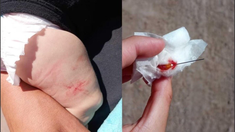 Ante la viralización del caso, desde la Secretaría de Salud de Florencio Varela iniciaron un sumario administrativo y apartaron de manera preventiva al enfermero encargado de la vacunación.