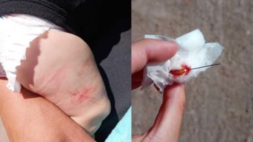 Ante la viralización del caso, desde la Secretaría de Salud de Florencio Varela iniciaron un sumario administrativo y apartaron de manera preventiva al enfermero encargado de la vacunación.