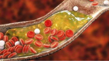 Los científicos resaltaron que la detección temprana es relevante porque entre el 20% y el 40% de los casos iniciales de enfermedad coronaria son mortales.