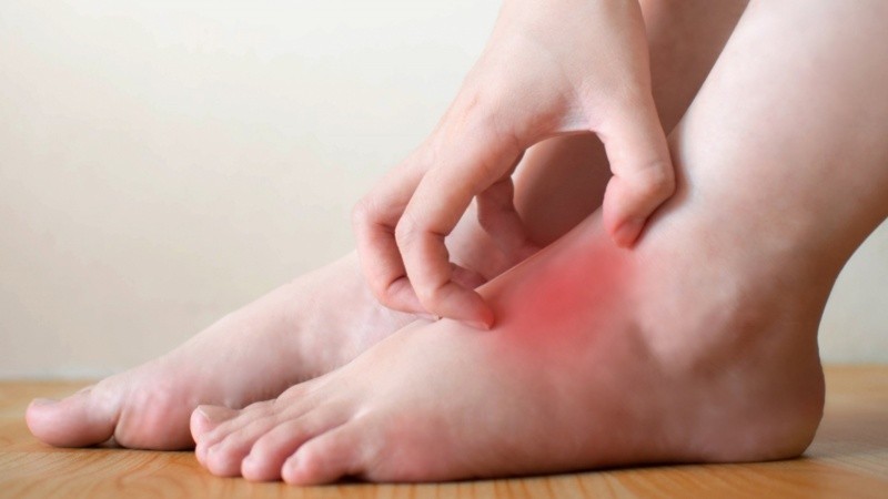 Incluso en el invierno, los pies necesitan de una correcta hidratación y cuidado.