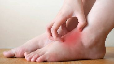 Incluso en el invierno, los pies necesitan de una correcta hidratación y cuidado.