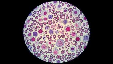 La pérdida de diversidad celular puede identificarse con la inflamación persistente en la vejez.