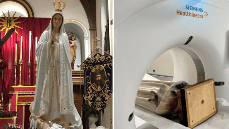 El hallazgo se produjo durante un estudio rutinario.