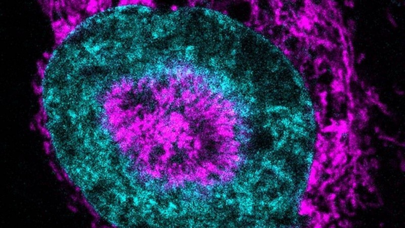 El estudio plantea la posibilidad de crear nuevas estrategias que las paralicen antes de que se expandan hacia otros órganos.