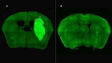Antes y después del tumor tratado con la nueva estrategia terapéutica.
