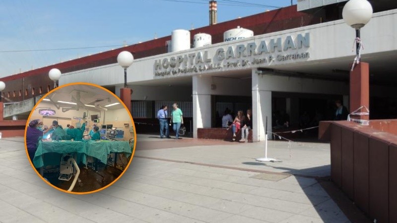 El Hospital Garrahan realiza entre una y dos cirugías de separación de siameses al año.