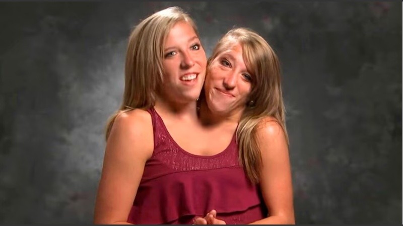 Las gemelas siamesas Abby y Brittany Hensel fueron fotografiadas trasladando a un recién nacido en Minnesota, lo que desató rumores sobre una posible maternidad.