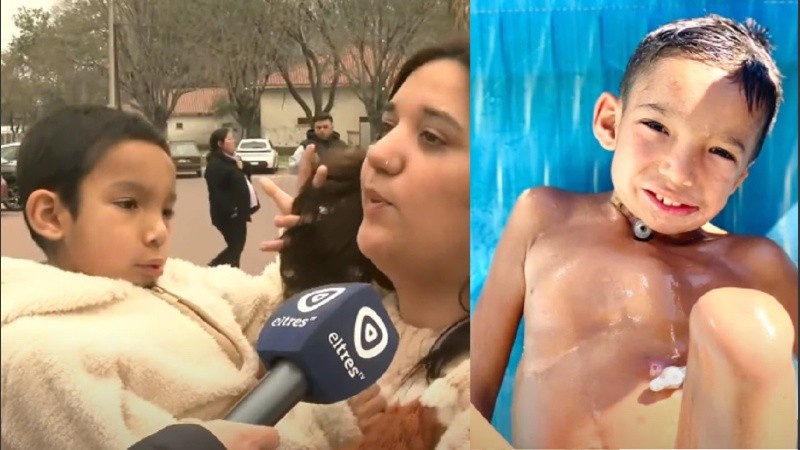 Bautista necesita operarse de la mandíbula para poder alimentarse sin la traqueotomía.